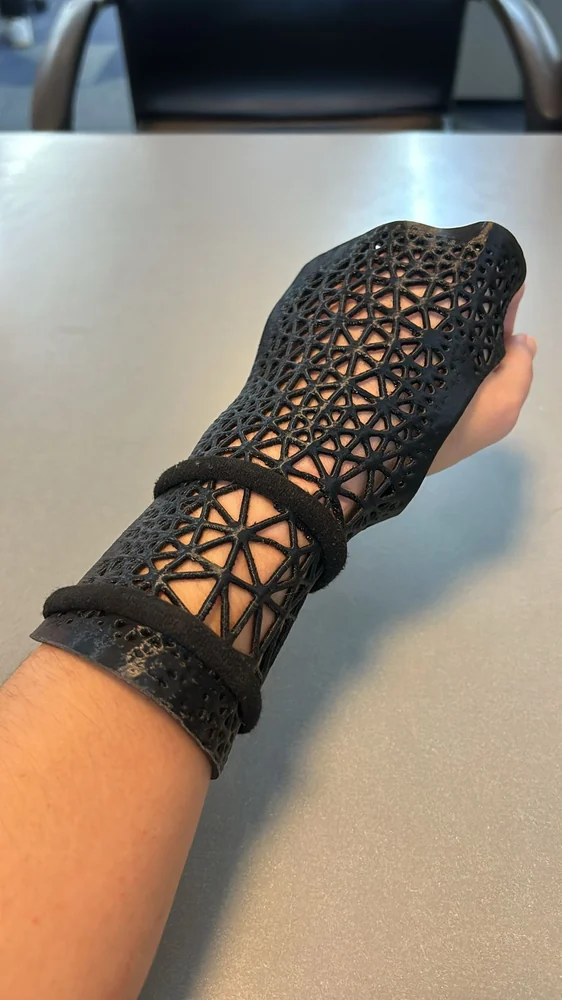 Ortesis negra reticulada en la mano y la muñeca, con el antebrazo apoyado sobre una mesa